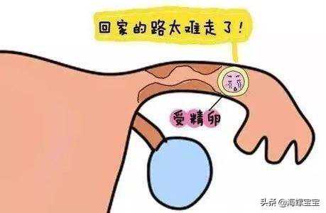 香港验血要怀孕几个月,做试管婴儿会宫外孕吗？