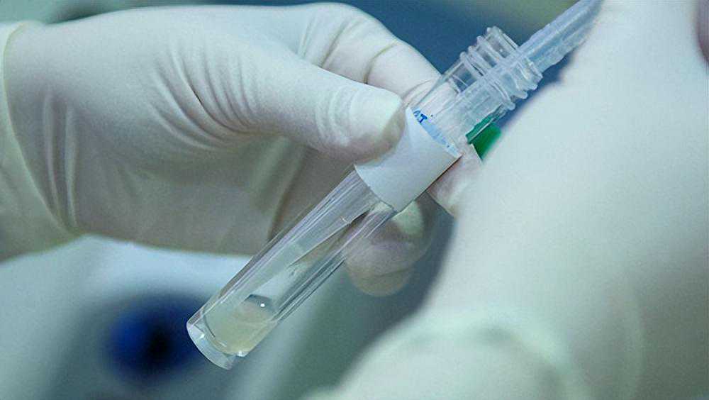 怀孕香港DNA验血是真的吗,人工受精双胞胎一次多少钱？人工授精备孕须知!