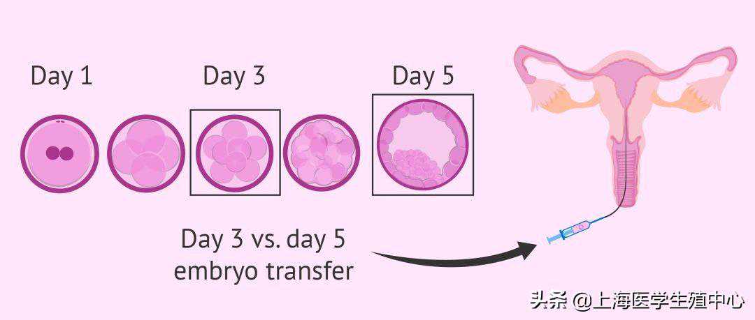 疫情期间香港验血要几天,试管婴儿移植是冻胚成功率高，还是鲜胚成功率高？